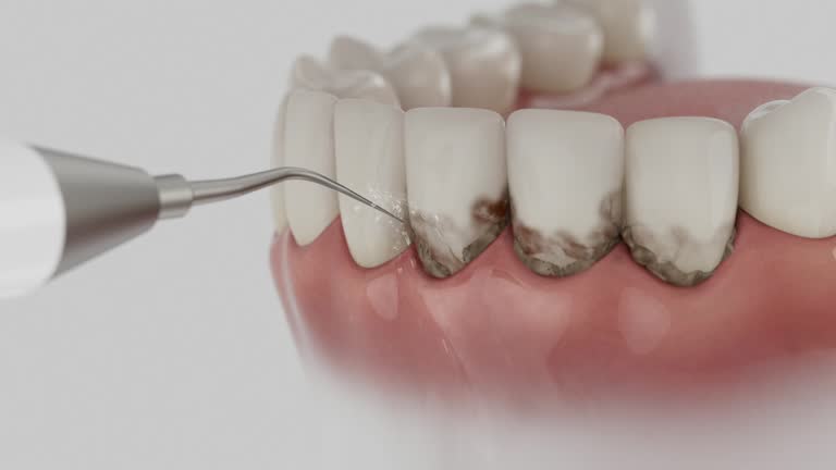Trusted Invisalign Clear Aligners service in McConnelsville, OH - Dentist Open Now